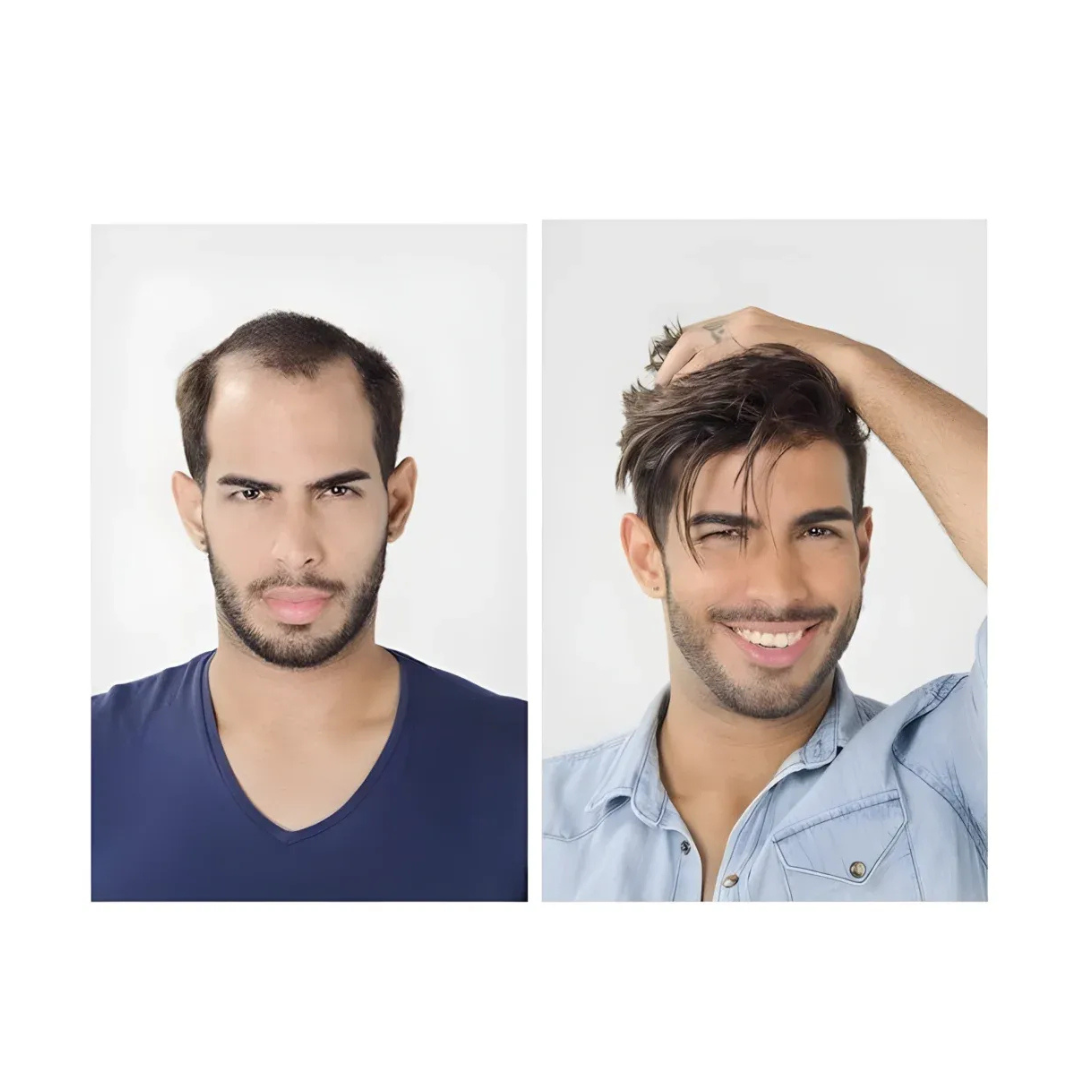 Frontal Hairline Hair Wigs
