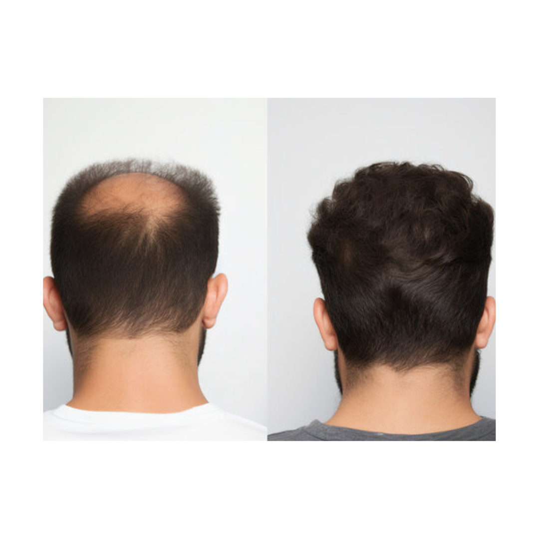 Mirage PU Hair Wigs