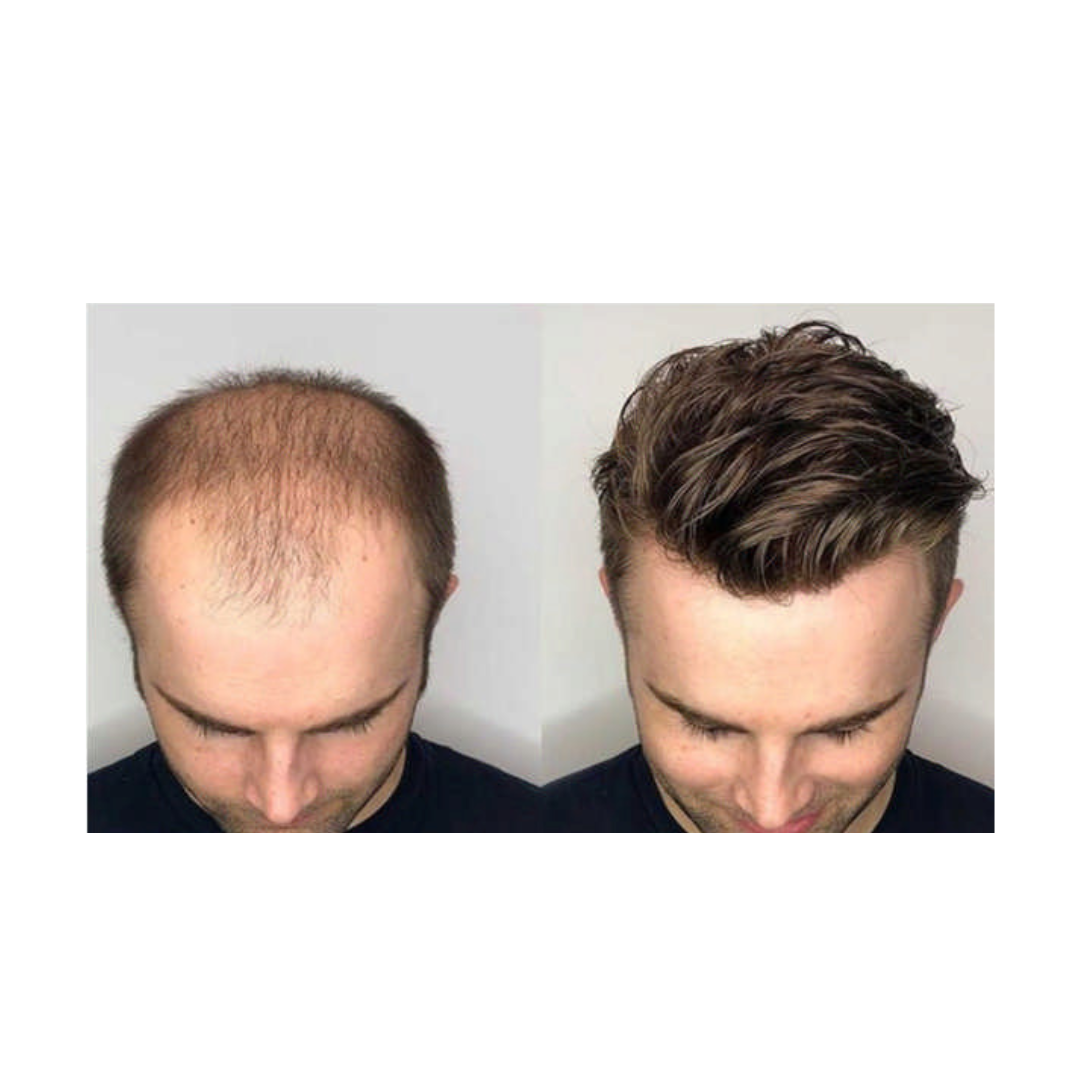 Australian Hair Wigs