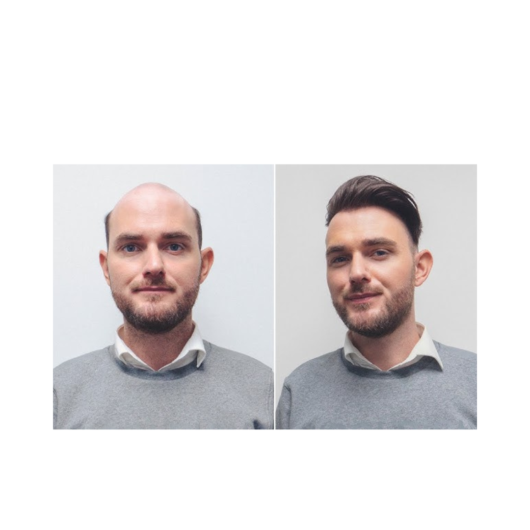 Octagon Hair Wigs