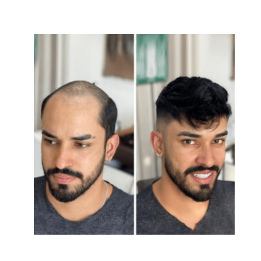 Frontal Hairline Lace Hair Wigs
