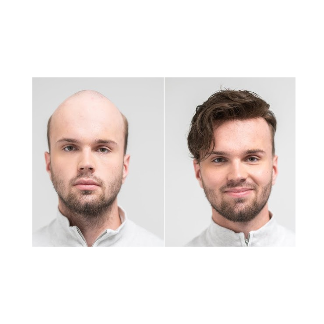 Q6 French Lace Patch Hair Wigs